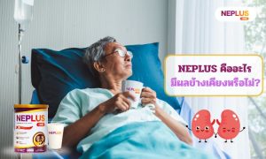 NEPLUS คืออะไร